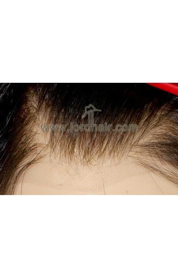 l12 hair replacement system