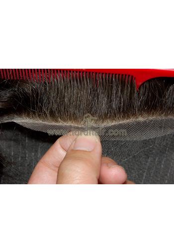 l12 hair replacement system