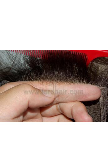 l12 hair replacement system