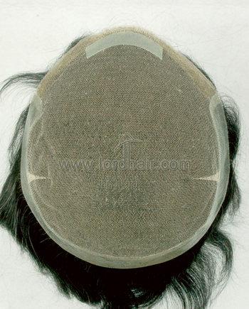 lace system with skin perimeter