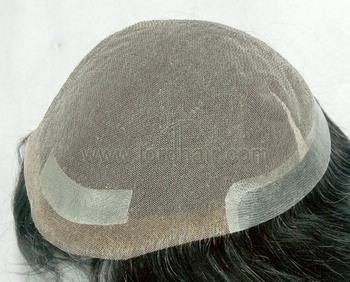 lace system with skin perimeter