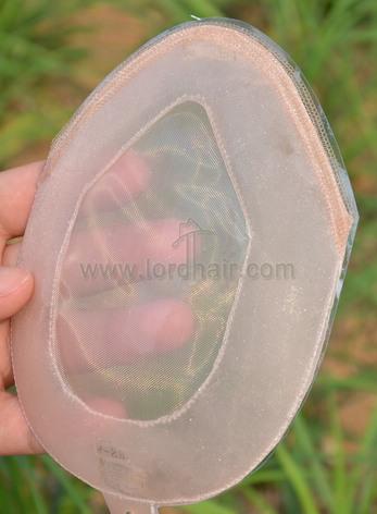 s9 hair replacement system