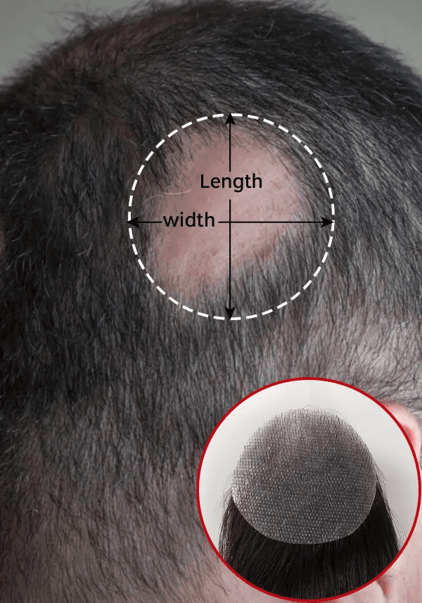 Patch Haarausfall-Pflaster (2 Stk.) Lordhair