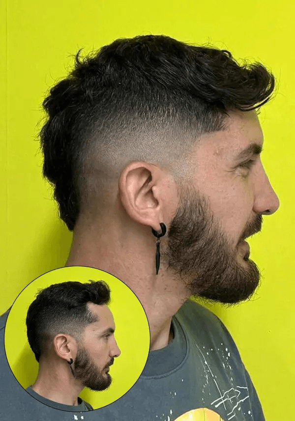 Haar Pflaster für Geheimratsecken Lordhair