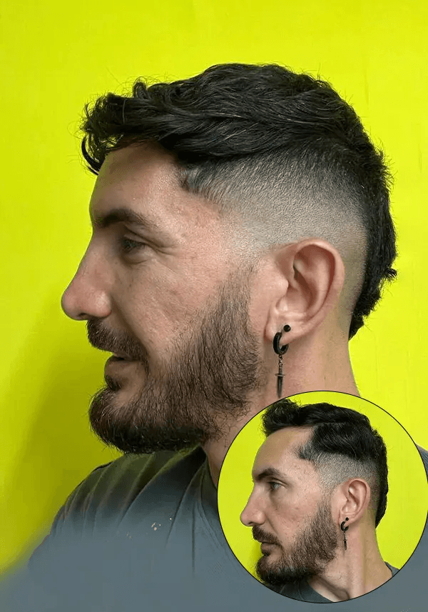 Haar Pflaster für Geheimratsecken Lordhair