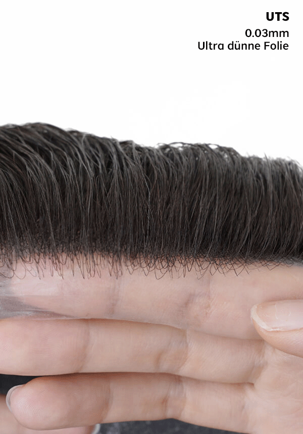 thin skin front hairline