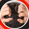 Was ist diffuser Haarausfall?