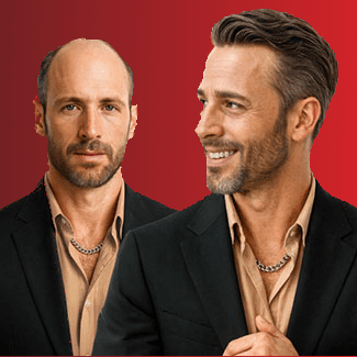 Haarsystem Lösungen für Sportler, Berufstätige und Männer mit besonderem Hauttyp