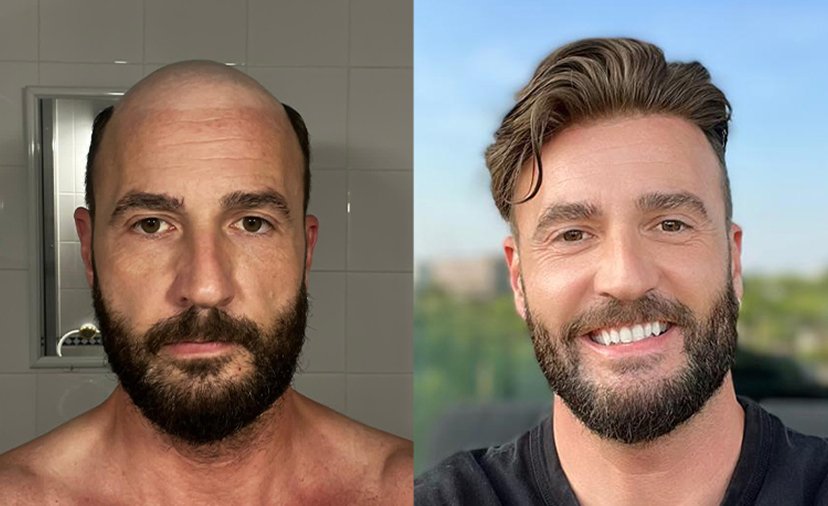 real results