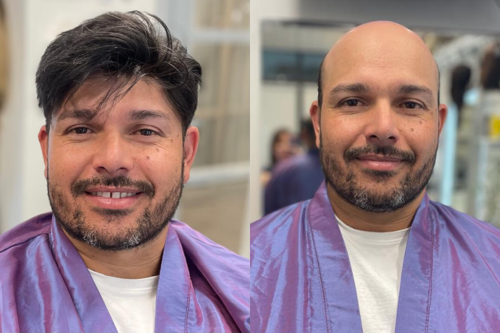 Vorher-Nachher-Effekt Vigor