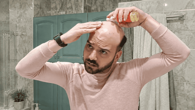 Kleber von Haarsystem entfernen