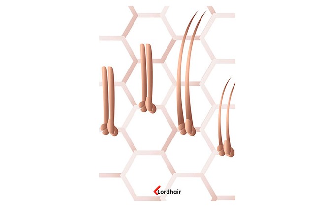 double split (doppelt geteilter knoten)