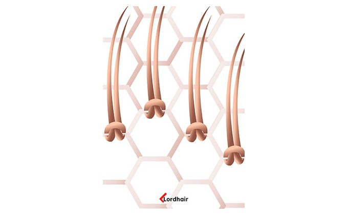 single knoten (einzelknoten)