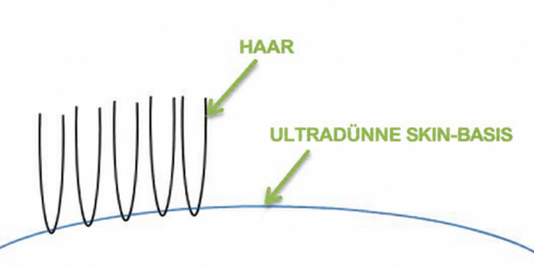 haarsystem v-loop technik