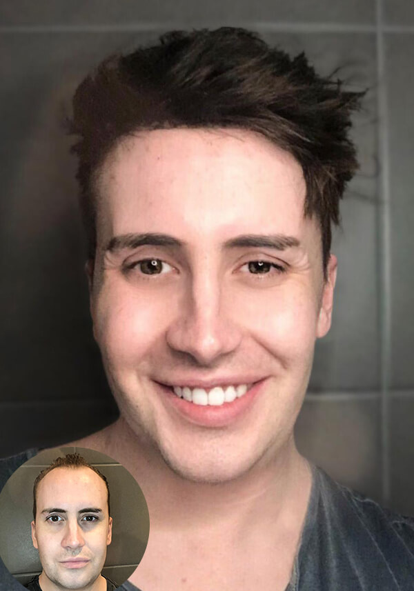 nach hinten gekämmtes Haar