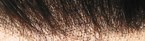 hair replacement non bleach knots hair replacement non bleach knots