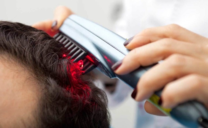 Low-Level-Lasertherapie
