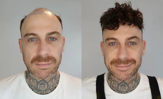 Brad vorher-nachher