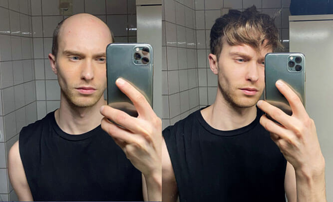 Juha mit und ohne Haarteil