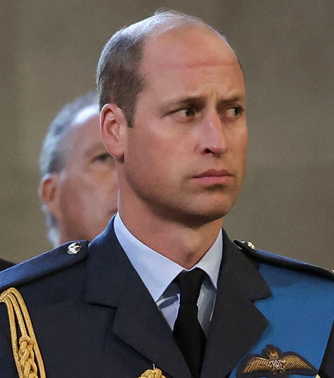 Prinz William Glatze