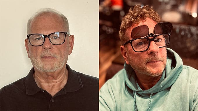 vorher-nachher Mit Toupet