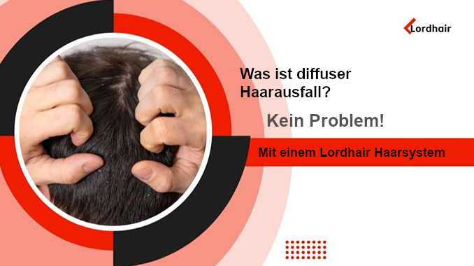 Diffuser Haarausfall bekämpfen