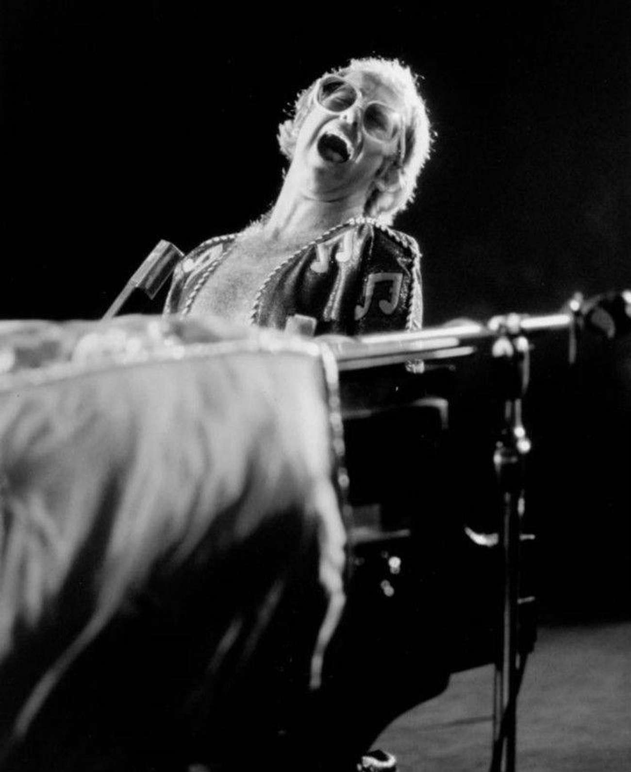 Elton John mit Haarverlust