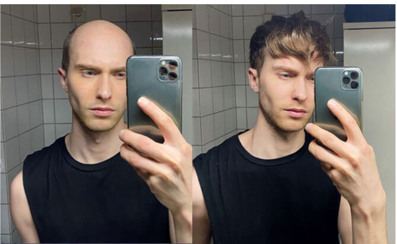 Vorher, nachher Fotos mit Toupet