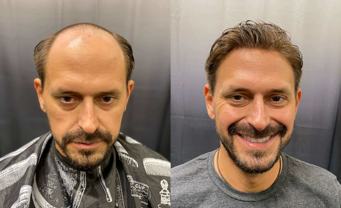 Welche Vorteile hat eine Maßanfertigung?