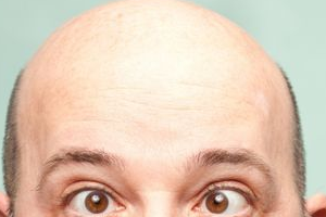 Wie lange hält ein Haarsystem