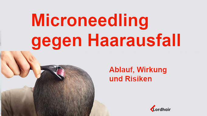 Microneedling für volles Haar