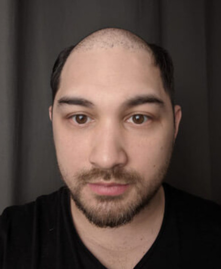 Profilbild ohne Perücke