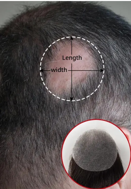 Selbstvertrauen bei dünnem Haar