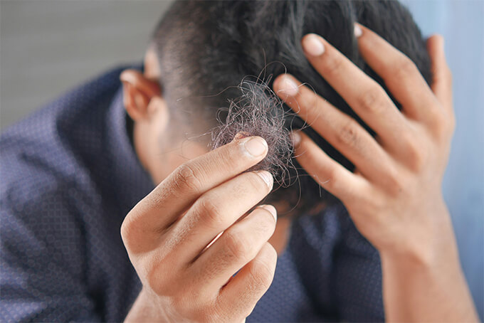 Toupet verliert Haare