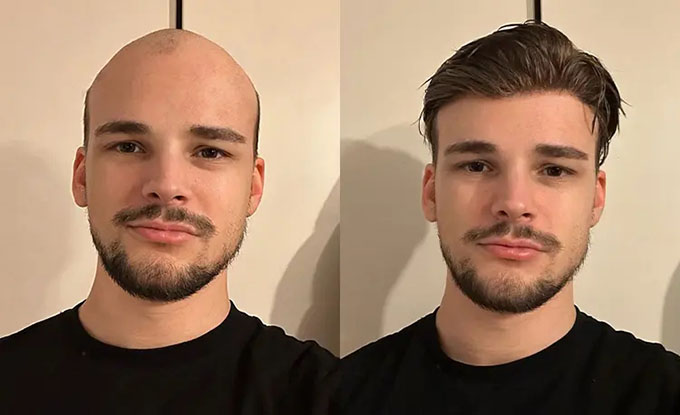 vorher/nachher