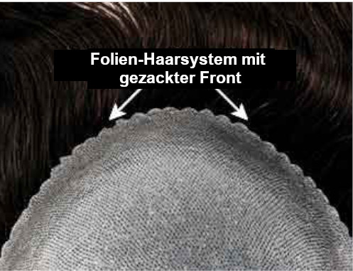 Natürlich aussehende Stirnlinie