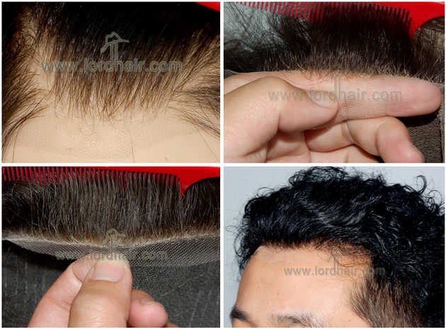 l12 hair replacement system l12 hair replacement system