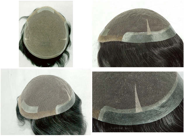 lace hair replacement system with skin perimeter