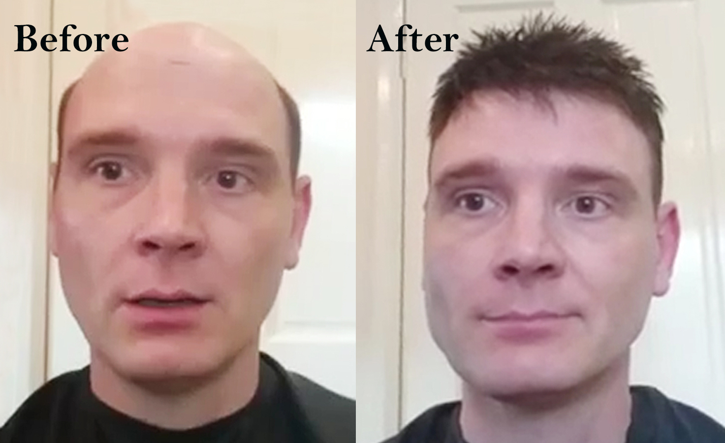 hair replacement systems customer photo
